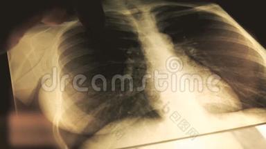 医生向病人解释胸部x线图像。 4K型特写镜头